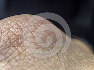 Macro human skin texture. Person skin. Dermatology background, health skin, caucasian color. Medicine pattern surface