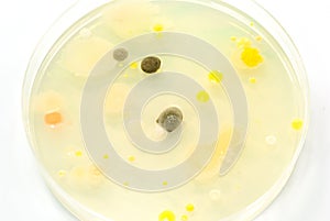 Macro mold and bacterai colonies growing on an aga