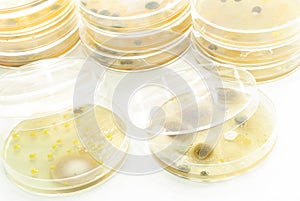 Macro mold and bacterai colonies growing on an aga