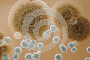 Macro mold colonies growing on an agar plates. photo