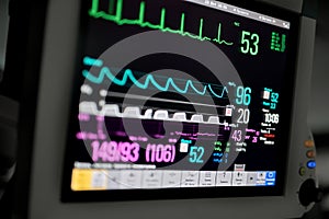Macro photo of EKG monitor