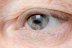 Macro photo of the human eye - overhanging upper eyelid, omitted eyelid ptosis, tired look of the old man, insomnia