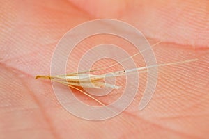 Macro photo of a tiny arrowheads of the foxtail grass. When a dog enters my consulting room shaking its head or licking its paw