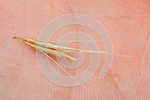 Macro photo of a tiny arrowheads of the foxtail grass. When a dog enters my consulting room shaking its head or licking its paw photo