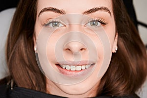 Macro photography of a beautiful female smile with white healthy teeth