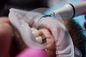 Macro photography. Top view on cleaning process in patient's mouth. Cleaning teeth with water jet and saliva ejector