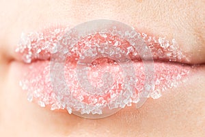 Macro photography of women& x27;s lips with sugar scrub, lip care, peeling of the lip skin
