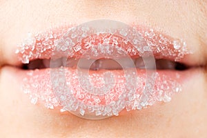 Macro photography of women& x27;s lips with sugar scrub, lip care, peeling of the lip skin