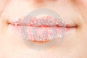 Macro photography of women& x27;s lips with sugar scrub, lip care, peeling of the lip skin