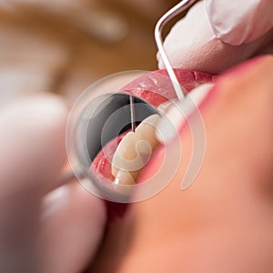 Macro shot of girl having dental check up in dental clinic. Dentist examining a patient`s teeth with dental tools