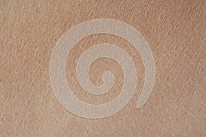 Macro of texture human skin