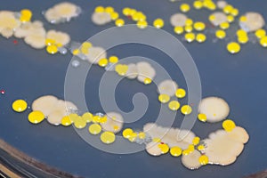 Macro view of bacteria and baker yeast colonies