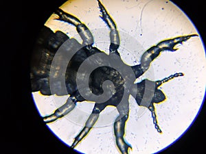Macro view of head louse