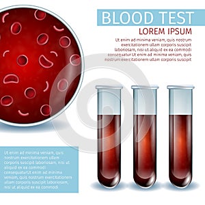 Hematology Medical Banner, Copy Space. Blood Test photo