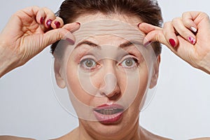 Macro Woman face with wrinkles on the forehead. Collagen and face injections concept. Menopause.