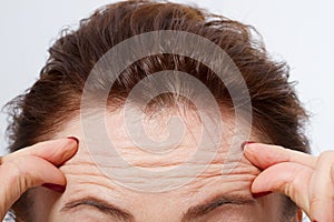 Macro Woman face with wrinkles on the forehead. Collagen and face injections concept. Menopause. Cropped image. Copy space and moc photo