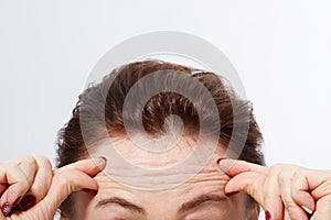 Macro Woman face with wrinkles on the forehead. Collagen and face injections concept. Menopause. Cropped image. Copy space