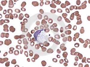 Macrophage in peripheral blood.