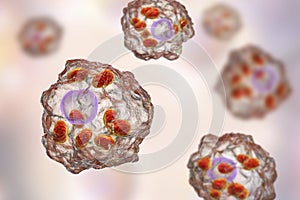 Macrophages infected by Leishmania amastigotes