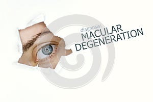 Macular degeneration disease poster with eye test chart and blue eye