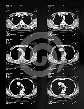 Magnetic resonance photo