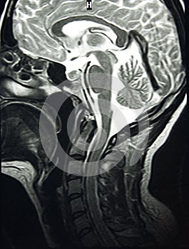 Magnetic Resonance of Brain