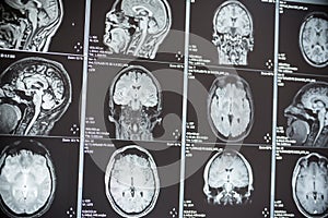 Magnetic resonance image of a brain