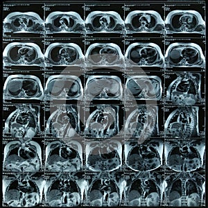 Magnetic resonance images photo