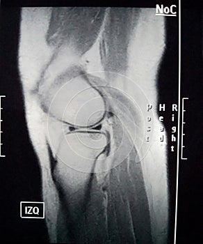 Magnetic resonance imaging