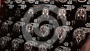 Magnetic resonance imaging of the human brain.