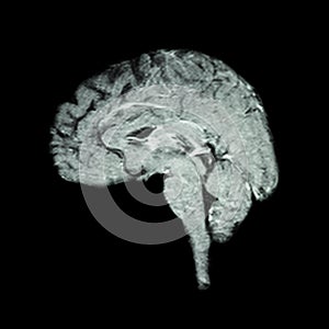 Magnetic Resonance Imaging ( MRI ) of brain ( Medical , science and healthcare concept )