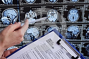 Magnetic resonance scan of the brain. MRI head scan