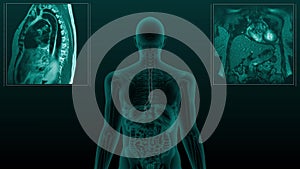 Magnetic resonance tomography scan of the human digestive system. Anatomically accurate 3d animation of the oesophagus.