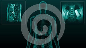 Magnetic resonance tomography scan of the human urinary system. 3d animation of ureter