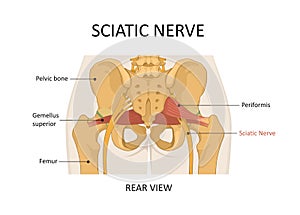 Sciatic nerve. The main causes of sciatica. photo