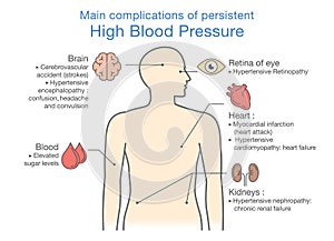 Main complications of persistent High Blood Pressure. photo