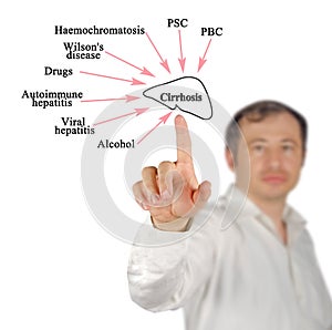 Major causes of Cirrhosis