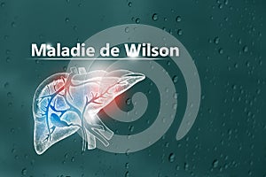 Maladie de Wilson, liste de contrÃ´le pour les patients. Fond texturÃ© avec copie vide pour le texte