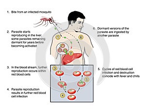 Malaria photo