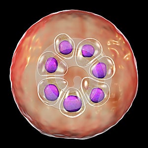 The malaria-infected red blood cell