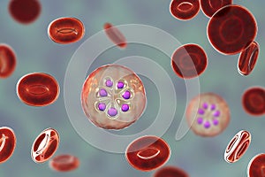 The malaria-infected red blood cell