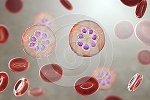 The malaria-infected red blood cell