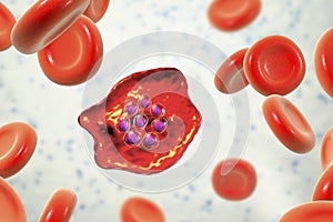 The malaria-infected red blood cell