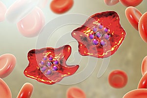 The malaria-infected red blood cell