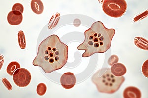 The malaria-infected red blood cell