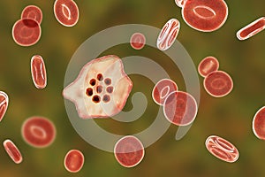 The malaria-infected red blood cell