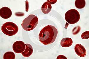 The malaria-infected red blood cells