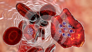 The malaria-infected red blood cells