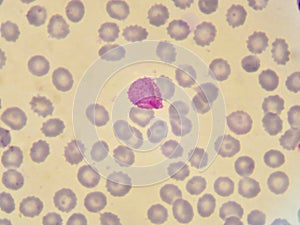 Malaria parasite