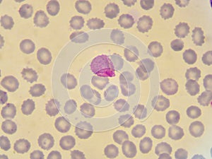 Malaria parasite photo